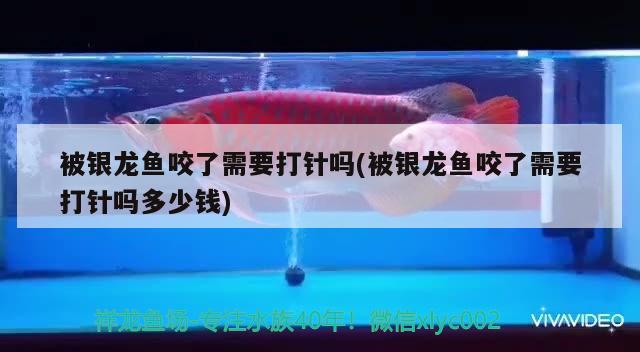 被銀龍魚咬了需要打針嗎(被銀龍魚咬了需要打針嗎多少錢) 銀龍魚百科