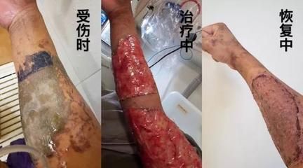 小虎魚身上有白膜正常嗎怎么治：小虎魚身上出現(xiàn)白膜正常嗎怎么治小虎魚身上有白膜正常嗎 虎魚百科 第2張