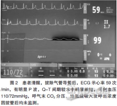 MS-222麻醉效果對(duì)比研究，ms-222與其他麻醉劑對(duì)比研究