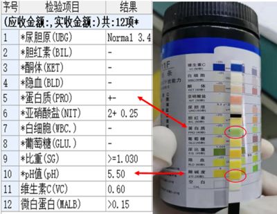 申古銀版魚(yú)適宜酸堿度調(diào)節(jié)技巧：申古銀版魚(yú)水質(zhì)管理要點(diǎn) 細(xì)線銀板魚(yú)苗 第2張