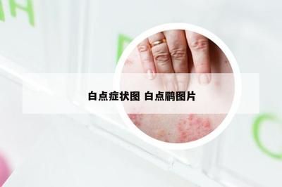 硝酸亞汞殘留對(duì)水質(zhì)影響：硝酸亞汞對(duì)水質(zhì)影響的詳細(xì)信息：硝酸亞汞對(duì)水質(zhì)影響 其他寵物 第5張