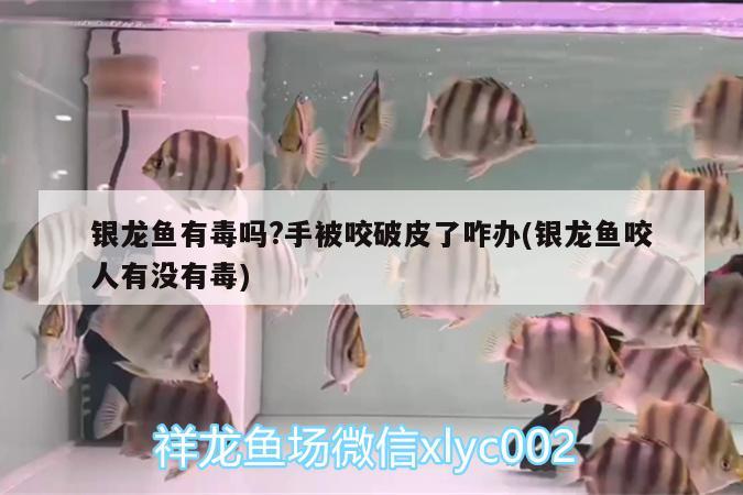 銀龍魚(yú)有毒嗎?手被咬破皮了咋辦(銀龍魚(yú)咬人有沒(méi)有毒) 銀龍魚(yú)百科