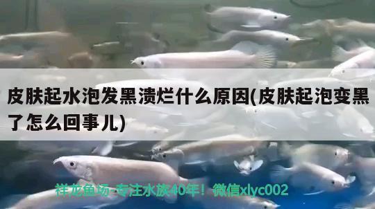 皮膚起水泡發(fā)黑潰爛什么原因(皮膚起泡變黑了怎么回事兒)